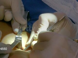 Aj lee from wwe gets her third breast implant: free reged film 8e